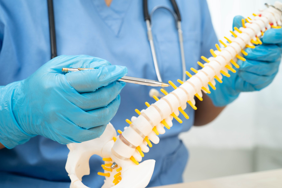 materiały partnera Schemat anatomiczny kręgosłupa lędźwiowego z zaznaczonym uciskiem na nerw kulszowy w odcinku L4-S1